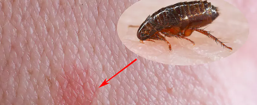 Flea Control for Humans Palmdale, CA